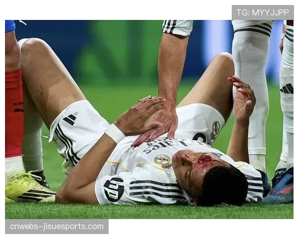 姆巴佩第88分钟疑似遭肘击，VAR回看后未判点球引争议